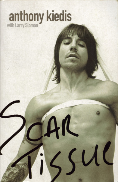 Anthony Kiedis