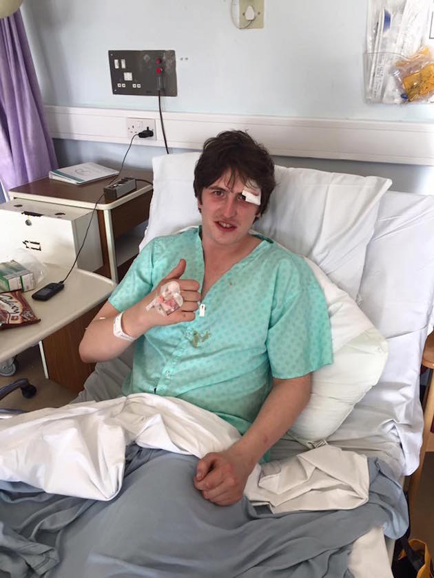 Cabbage's Lee Broadbent in hospital after breaking his pubic rami